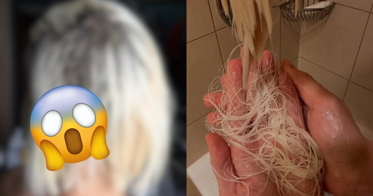 Famous Celebrity Cuts Hair Short Following Severe Damage 1 Popular Star Shaves Her Head After Extreme Hair Damage