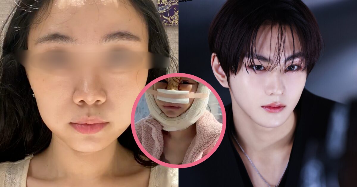 Woman’s Unsettling Plastic Surgery Change Into ENHYPEN’s Jungwon Ignites Controversy 1 Woman's "Eerie" Plastic Surgery Transformation Into ENHYPEN's Jungwon Sparks Debate