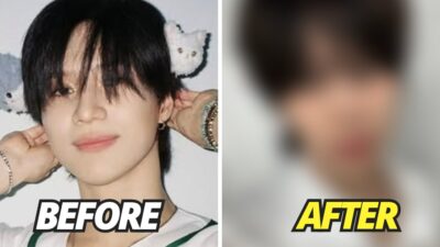 SHINee Taemin’s Alleged Nose Job Sparks Concern Over Surgery Results