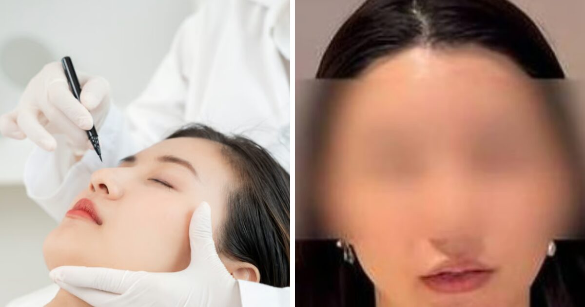 Woman's Botched Plastic Surgery In South Korea Ends In Disturbing Facial Scar