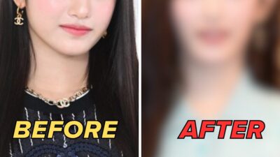Popular 4th Gen Idol's Unexpected Facial Feature Change Triggers Major Reactions