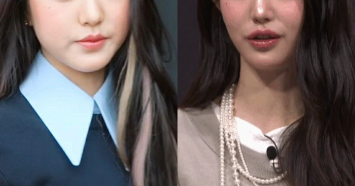 Massive Increase in Plastic Surgery Among Idols Triggers Intense Debate 1 Huge Surge In Plastic Surgery Among Idols Sparks Fierce Debate