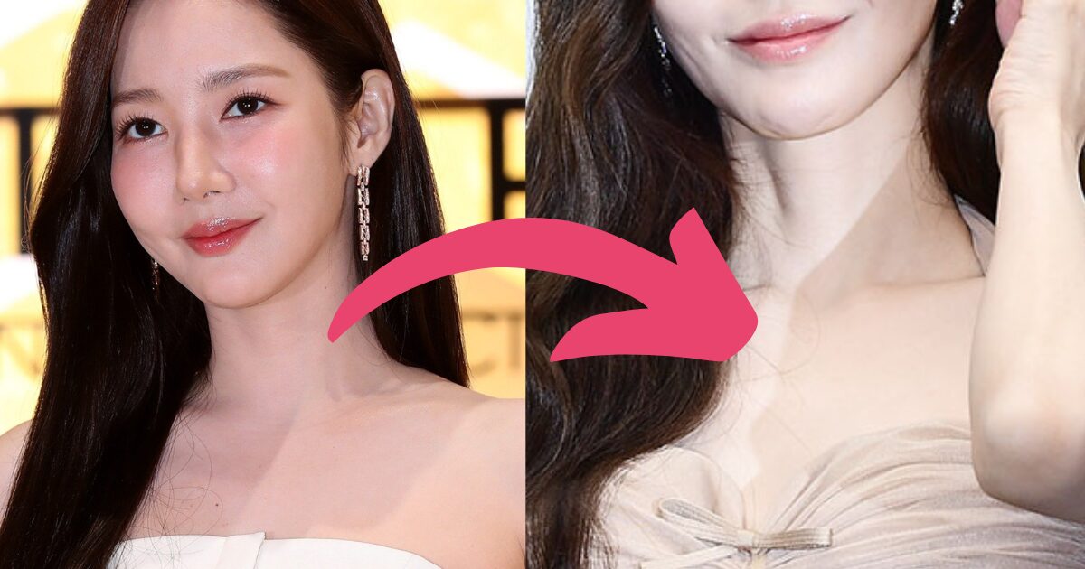 Actress Park Min Young Stuns With Concerning Appearance Following Weight Loss 1 Actress Park Min Young Shocks With Worrying Visuals After Weight Loss