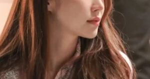Popular Actress Reveals Burn Scar On Her Face For The First Time—Here's What Happened