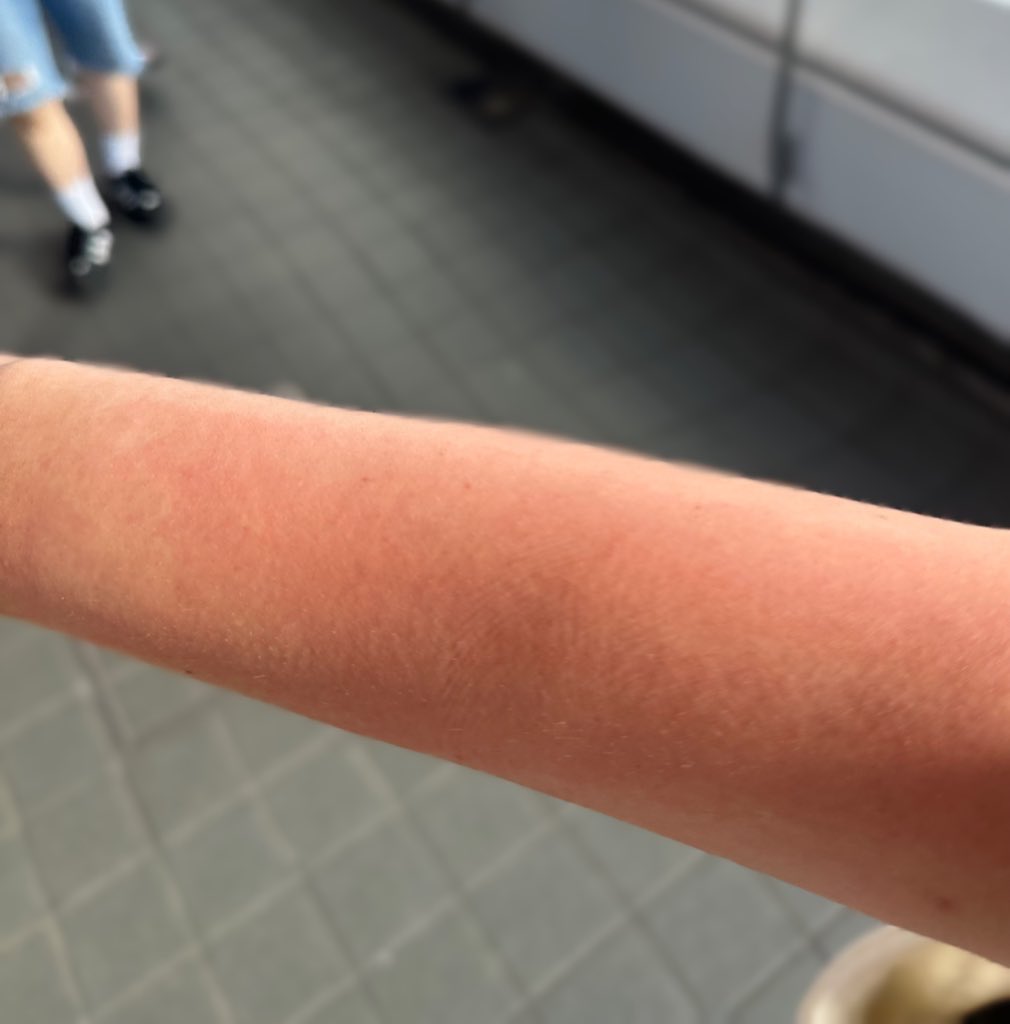 K-Pop Enthusiast Sexually Assaulted by Male Security Guard Sparks Fierce Backlash 2 Cuts and bruises