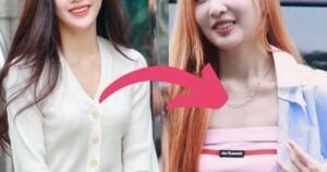 3rd Generation Idol's Visuals Get Flamed Due To Alleged "Botched Plastic Surgery"