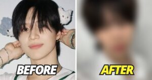 SHINee Taemin’s Alleged Nose Job Sparks Concern Over Surgery Results