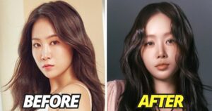 Soyou Addresses Plastic Surgery Accusations After Appearing Unrecognizable