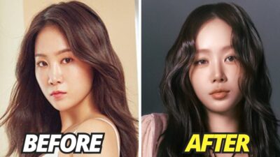 Soyou Addresses Plastic Surgery Accusations After Appearing Unrecognizable
