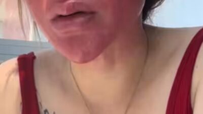 Woman Goes 22 Years Without Removing Makeup — Here Is Her Face Now